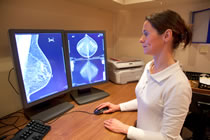 Supervised Mammograms