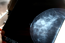 Breast Imaging